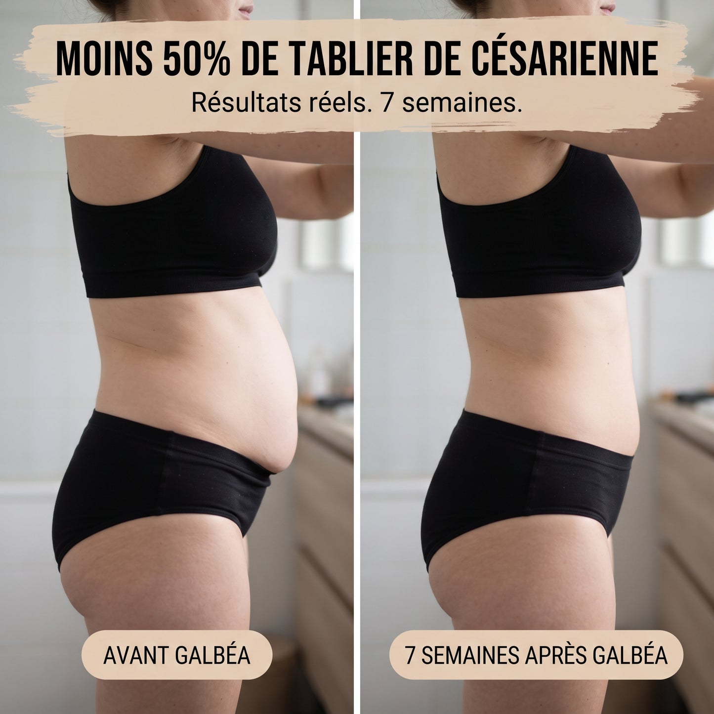 Galbéa™ Culotte Post-Partum - Compression 360°