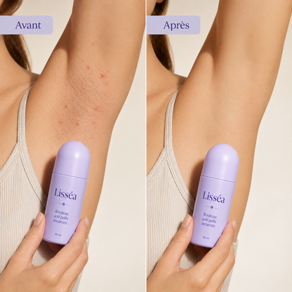 Lisséa™ Rouleau Anti Poils Incarnés